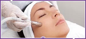 Microdermabrasion Treatment Near Me in Dearborn, MI Microdermabrasion Treatment Near Me in Dearborn, MI