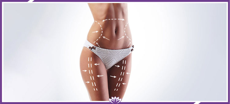 Smartlipo Treatment Professionals Near Me in Dearborn, MI Smartlipo Treatment Professionals Near Me in Dearborn, MI