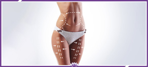 Smartlipo Treatment Professionals Near Me in Dearborn, MI Smartlipo Treatment Professionals Near Me in Dearborn, MI