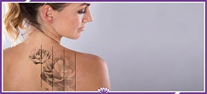 Laser Tattoo Removal Specialist Near Me in Dearborn, MI Laser Tattoo Removal Specialist Near Me in Dearborn, MI