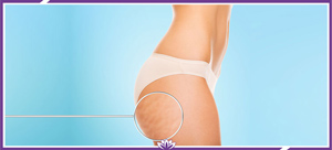 Vaser Quanta Shape Skin Tightening Specialist Near Me in Dearborn, MI Vaser Quanta Shape Skin Tightening Specialist Near Me in Dearborn, MI