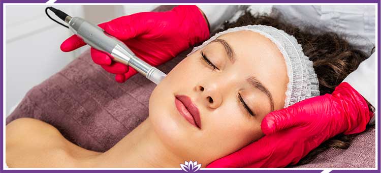 RF Microneedling Specialist Near Me in Dearborn, MI RF Microneedling Specialist Near Me in Dearborn, MI