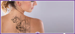 Laser Tattoo Removal Therapist Course Near Me in Dearborn, MI Laser Tattoo Removal Therapist Course Near Me in Dearborn, MI