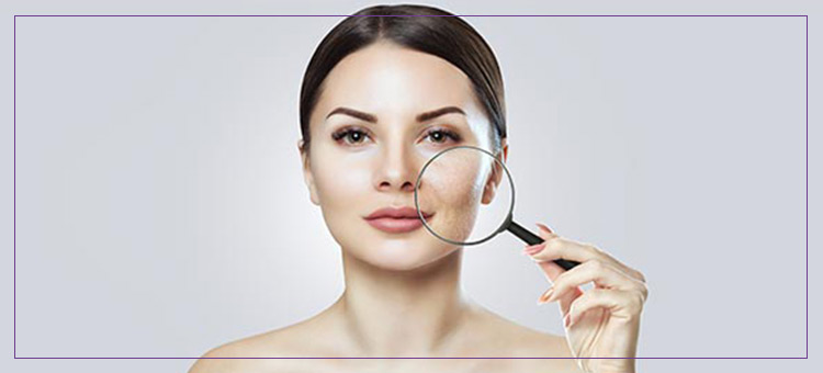 Acne Treatment Near Me in Dearborn, MI | Laser Duet