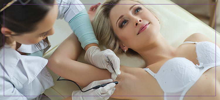 Electrolysis Hair Removal Specialist Near Me in Dearborn, MI