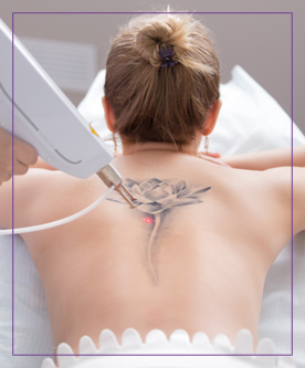 Laser Tattoo Removal Therapist Course Near Me in Dearborn, MI