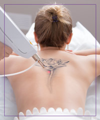 Laser Tattoo Removal Therapist Course Near Me in Dearborn, MI