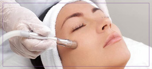 Microdermabrasion Treatment Near Me in Dearborn, MI