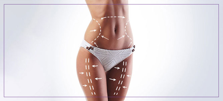 Smartlipo Treatment Professionals Near Me in Dearborn, MI