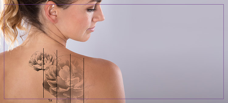 Laser Tattoo Removal Therapist Course Near Me in Dearborn, MI