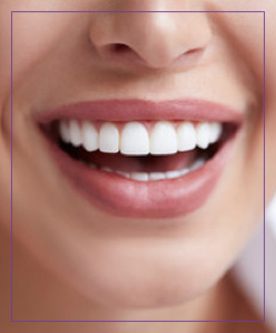 Teeth Whitening Near Me in Dearborn, MI