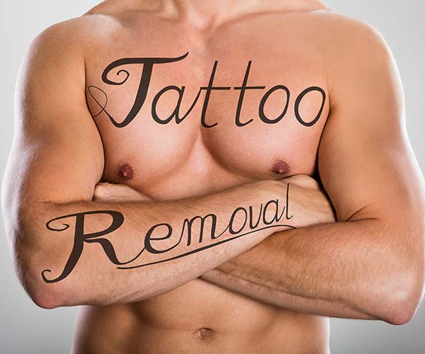 Picoway Laser Tattoo Removal Near Me in Dearborn, MI