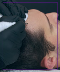 Scalp Micropigmentation (SMP) Specialist Near Me in Dearborn, MI