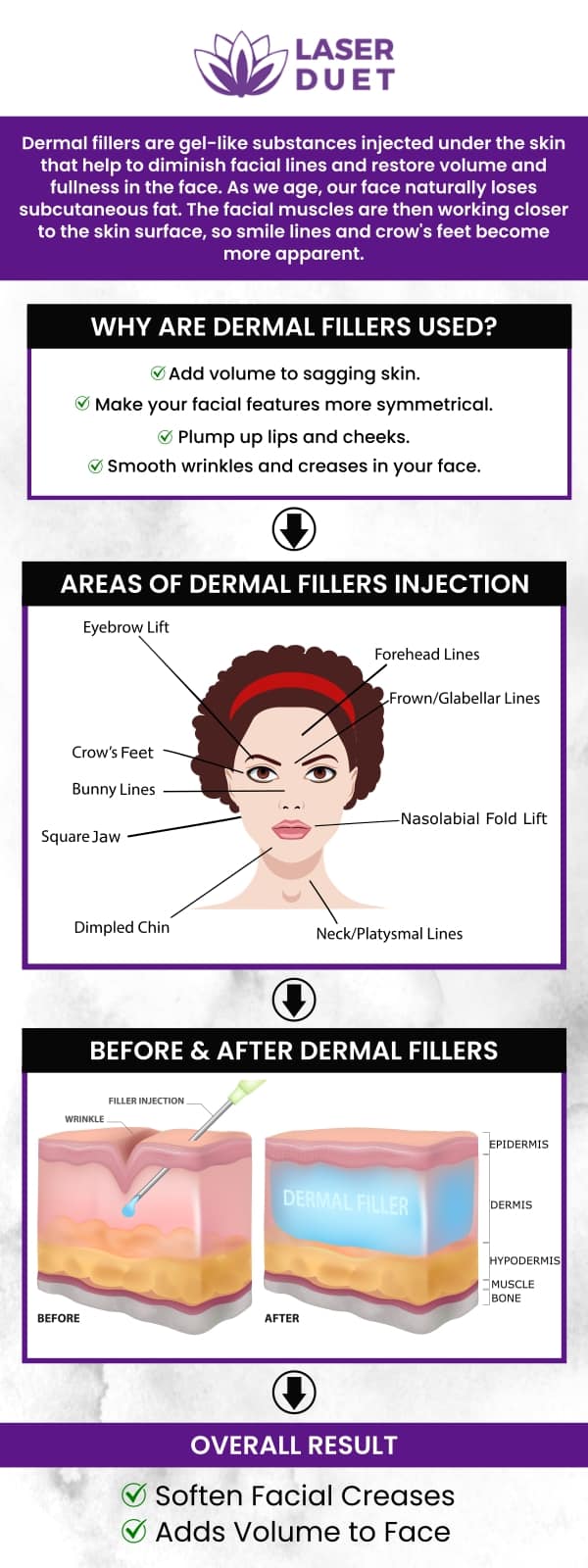 Want to diminish facial lines or restore volume of face? Visit Laser Duet Med Spa, where our trained professionals offer dermal fillers to plump your lips, fill in lines, enhance & restore volume to aging skin. For more information, contact us or schedule an appointment online. We are conveniently located at 15238 W Warren Ave Ste #A Dearborn, MI 48126. We serve clients from Dearborn MI, Melvindale MI, River Rouge MI, Allen Park MI, Lincoln Park MI, Dearborn Heights MI, Ecorse MI, and surrounding areas!