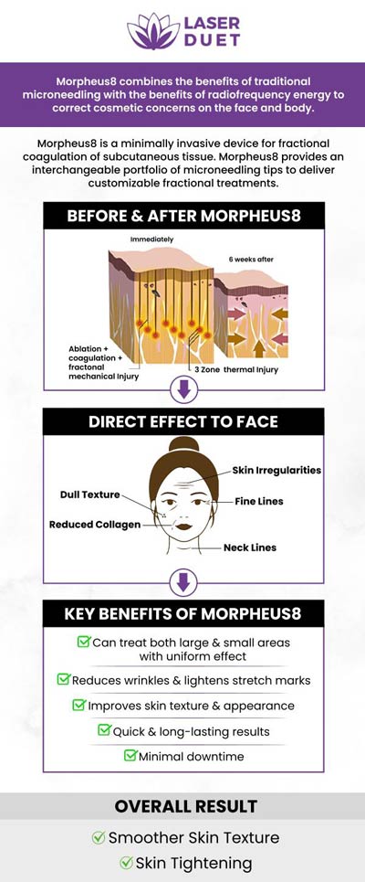 Morpheus8 RF microneedling helps in skin tightening, reducing wrinkles and pores, and it also improves collagen production. At Laser Duet, our specialist will treat you and solve your skin problems. Contact us today or book an appointment online. Our clinic is conveniently located at 15238 W Warren Ave Ste #A, Dearborn, MI 48126.