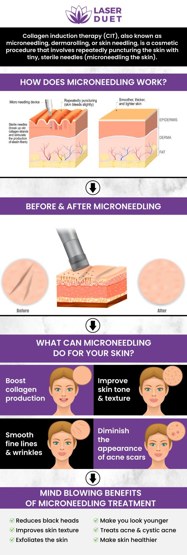 Get rid of acne scars, sagging skin, and stretch with microneedling at Laser Duet, a revolutionary and minimally invasive procedure that will boost your looks and confidence. Contact us today or book an appointment. Our clinic is conveniently located at 15238 W Warren Ave Ste #A, Dearborn, MI 48126.