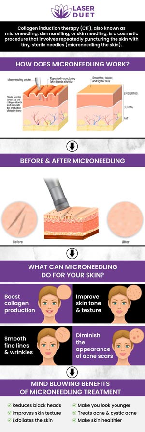 Get rid of acne scars, sagging skin, and stretch with microneedling at Laser Duet, a revolutionary and minimally invasive procedure that will boost your looks and confidence. Contact us today or book an appointment. Our clinic is conveniently located at 15238 W Warren Ave Ste #A, Dearborn, MI 48126.