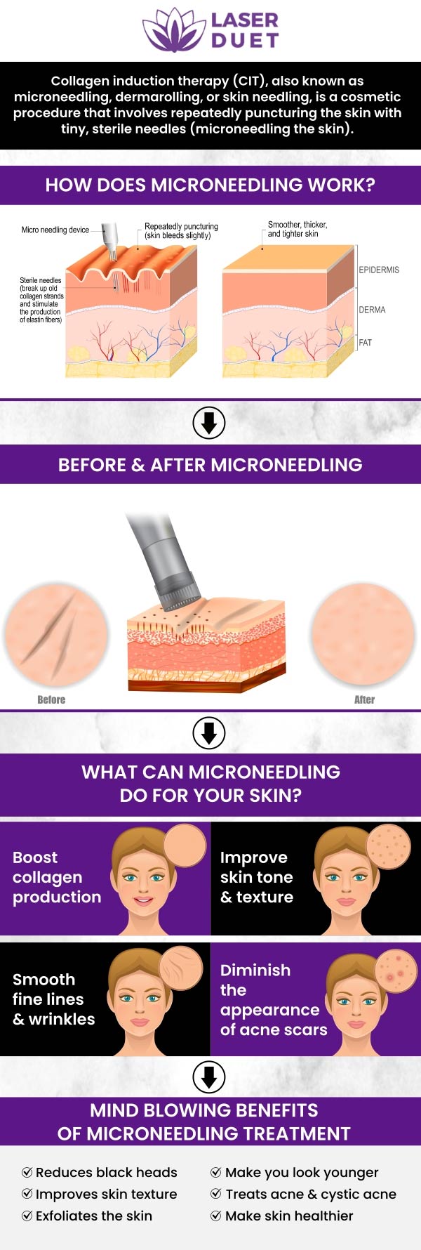 Radiofrequency microneedling is an anti-aging procedure that tightens, tones, and smooths skin texture. Achieve instantly tighter, firmer-looking skin with RF microneedling at Laser Duet. For more information, contact us today or book an appointment with Laser Duet today! Our clinic is conveniently located at 15238 W Warren Ave Ste #A, Dearborn, MI 48126.