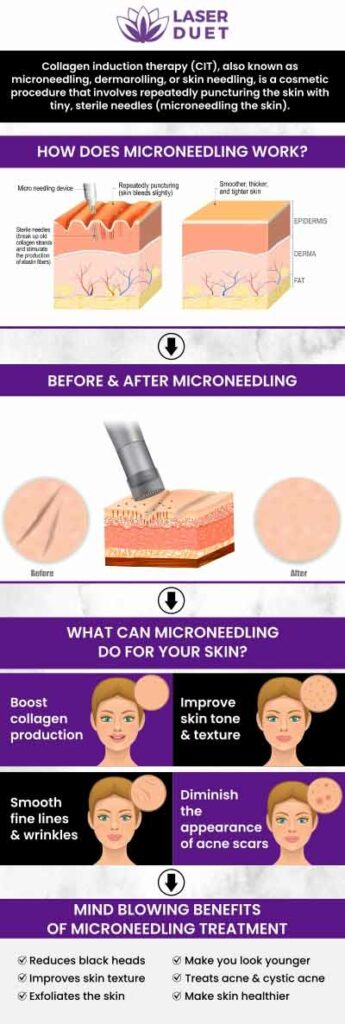 Microneedling can help to reduce the appearance of fine lines, wrinkles, and scars, while also improving the texture and tone of the skin. With the right guidance and expertise, microneedling can be a safe and effective way to achieve a more youthful, radiant complexion. Microneedling is available at Laser Duet Med Spa in Dearborn, MI. For more information contact us or book an appointment online. We are conveniently located at 15238 W Warren Ave Ste #A, Dearborn, MI 48126.