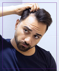 Low-Level Laser Therapy (LLLT) for Hair Loss Near Me in Dearborn, MI