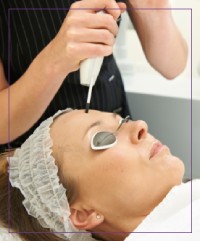 Q Switch Laser Treatment Near Me in Dearborn, MI