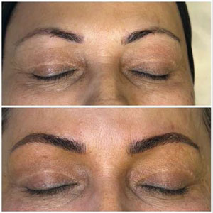 Microblading Before and After Photos of Clients at Laser Duet Med Spa in Dearborn, MI Microblading Before and After Photos of Clients at Laser Duet Med Spa in Dearborn, MI
