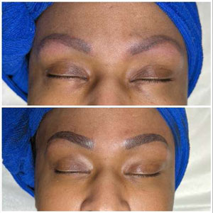 Microblading Before and After Photos of Clients at Laser Duet Med Spa in Dearborn, MI Microblading Before and After Photos of Clients at Laser Duet Med Spa in Dearborn, MI