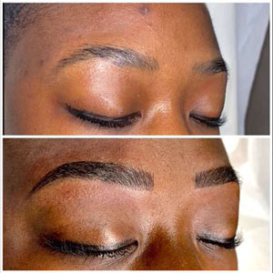 Microblading Before and After Photos of Clients at Laser Duet Med Spa in Dearborn, MI Microblading Before and After Photos of Clients at Laser Duet Med Spa in Dearborn, MI