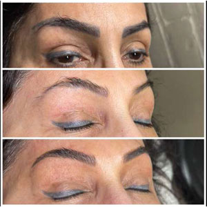 Microblading Before and After Photos of Clients at Laser Duet Med Spa in Dearborn, MI Microblading Before and After Photos of Clients at Laser Duet Med Spa in Dearborn, MI