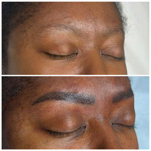 Microblading Before and After Photos of Clients at Laser Duet Med Spa in Dearborn, MI Microblading Before and After Photos of Clients at Laser Duet Med Spa in Dearborn, MI