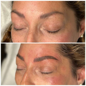 Microblading Before and After Photos of Clients at Laser Duet Med Spa in Dearborn, MI Microblading Before and After Photos of Clients at Laser Duet Med Spa in Dearborn, MI