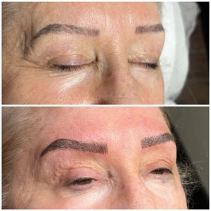 Microblading Before and After Photos of Clients at Laser Duet Med Spa in Dearborn, MI Microblading Before and After Photos of Clients at Laser Duet Med Spa in Dearborn, MI