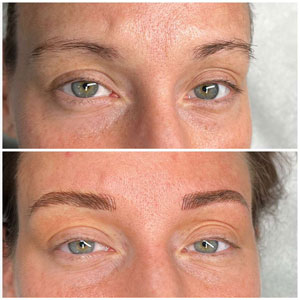 Microblading Before and After Photos of Clients at Laser Duet Med Spa in Dearborn, MI Microblading Before and After Photos of Clients at Laser Duet Med Spa in Dearborn, MI