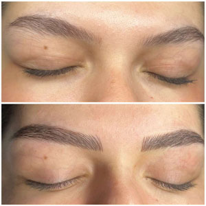 Microblading Before and After Photos of Clients at Laser Duet Med Spa in Dearborn, MI Microblading Before and After Photos of Clients at Laser Duet Med Spa in Dearborn, MI