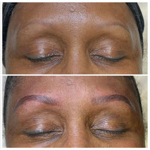 Microblading Before and After Photos of Clients at Laser Duet Med Spa in Dearborn, MI Microblading Before and After Photos of Clients at Laser Duet Med Spa in Dearborn, MI