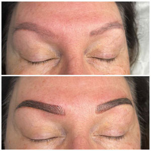 Microblading Before and After Photos of Clients at Laser Duet Med Spa in Dearborn, MI Microblading Before and After Photos of Clients at Laser Duet Med Spa in Dearborn, MI