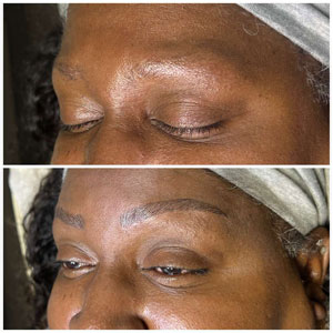 Microblading Before and After Photos of Clients at Laser Duet Med Spa in Dearborn, MI Microblading Before and After Photos of Clients at Laser Duet Med Spa in Dearborn, MI