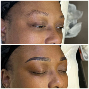 Microblading Before and After Photos of Clients at Laser Duet Med Spa in Dearborn, MI Microblading Before and After Photos of Clients at Laser Duet Med Spa in Dearborn, MI