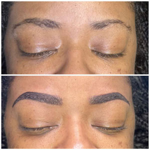 Microblading Before and After Photos of Clients at Laser Duet Med Spa in Dearborn, MI Microblading Before and After Photos of Clients at Laser Duet Med Spa in Dearborn, MI