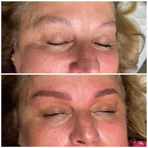 Microblading Before and After Photos of Clients at Laser Duet Med Spa in Dearborn, MI Microblading Before and After Photos of Clients at Laser Duet Med Spa in Dearborn, MI