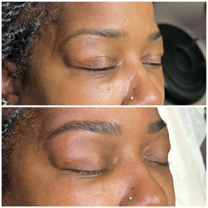 Microblading Before and After Photos of Clients at Laser Duet Med Spa in Dearborn, MI Microblading Before and After Photos of Clients at Laser Duet Med Spa in Dearborn, MI