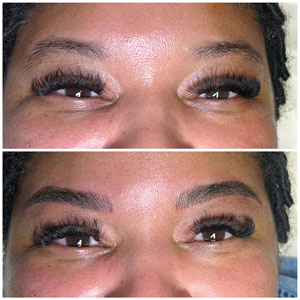 Microblading Before and After Photos of Clients at Laser Duet Med Spa in Dearborn, MI Microblading Before and After Photos of Clients at Laser Duet Med Spa in Dearborn, MI