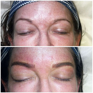 Microblading Before and After Photos of Clients at Laser Duet Med Spa in Dearborn, MI Microblading Before and After Photos of Clients at Laser Duet Med Spa in Dearborn, MI