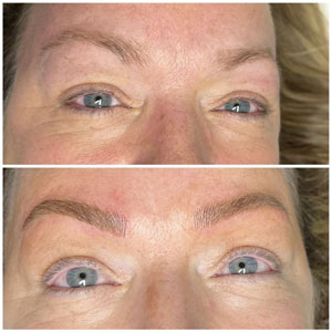 Microblading Before and After Photos of Clients at Laser Duet Med Spa in Dearborn, MI Microblading Before and After Photos of Clients at Laser Duet Med Spa in Dearborn, MI