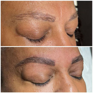 Microblading Before and After Photos of Clients at Laser Duet Med Spa in Dearborn, MI Microblading Before and After Photos of Clients at Laser Duet Med Spa in Dearborn, MI