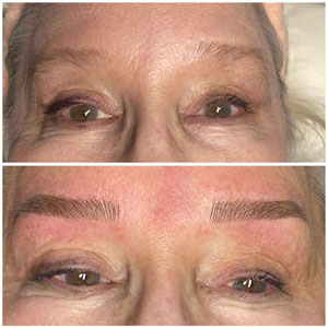 Microblading Before and After Photos of Clients at Laser Duet Med Spa in Dearborn, MI Microblading Before and After Photos of Clients at Laser Duet Med Spa in Dearborn, MI