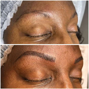 Microblading Before and After Photos of Clients at Laser Duet Med Spa in Dearborn, MI Microblading Before and After Photos of Clients at Laser Duet Med Spa in Dearborn, MI