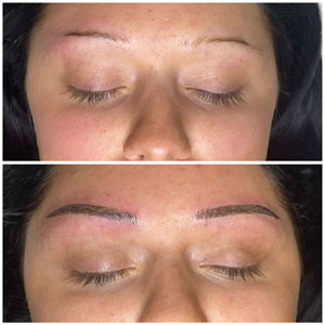 Microblading Before and After Photos of Clients at Laser Duet Med Spa in Dearborn, MI Microblading Before and After Photos of Clients at Laser Duet Med Spa in Dearborn, MI
