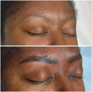 Microblading Before and After Photos of Clients at Laser Duet Med Spa in Dearborn, MI Microblading Before and After Photos of Clients at Laser Duet Med Spa in Dearborn, MI