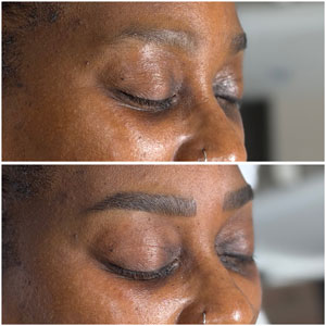 Microblading Before and After Photos of Clients at Laser Duet Med Spa in Dearborn, MI Microblading Before and After Photos of Clients at Laser Duet Med Spa in Dearborn, MI